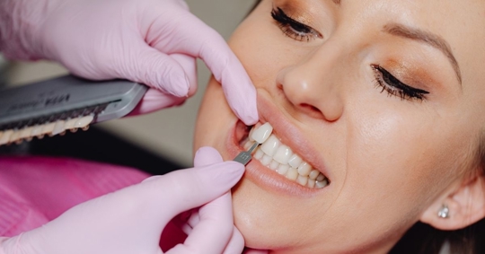 Dentist placing veneers on patient
