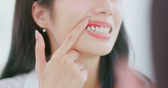 Woman with swelling gums